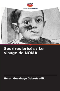 Sourires brisés