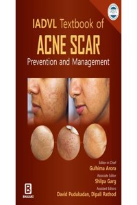 Iadvl Textbook Of Acne Scar Prevention And Management
