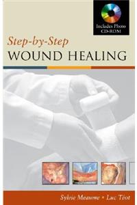 Step-By-Step Wound Healing