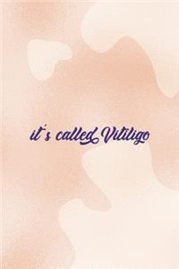It's Called Vitiligo