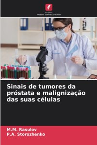Sinais de tumores da próstata e malignização das suas células
