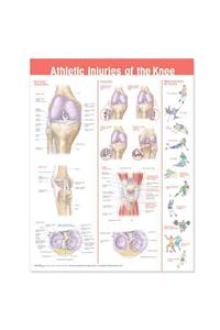 Athletic Injuries of the Knee Anatomical Chart