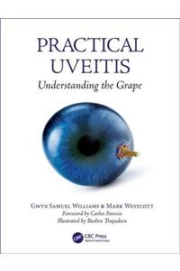 Practical Uveitis