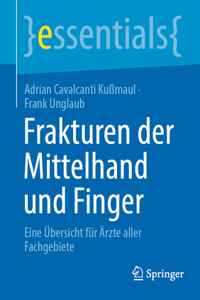 Frakturen Der Mittelhand Und Finger