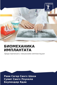 БИОМЕХАНИКА ИМПЛАНТАТА