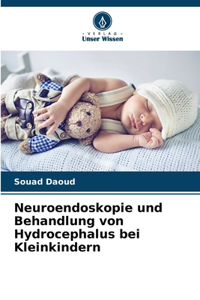 Neuroendoskopie und Behandlung von Hydrocephalus bei Kleinkindern