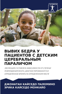 ВЫВИХ БЕДРА У ПАЦИЕНТОВ С ДЕТСКИМ ЦЕРЕБР
