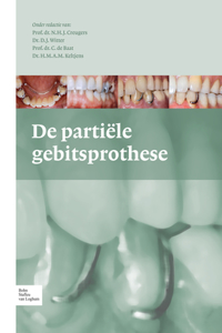 de Partiële Gebitsprothese