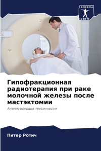 Гипофракционная радиотерапия при раке мо