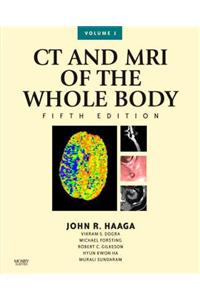 CT and MRI of the Whole Body