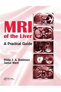 MRI of the Liver