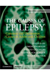 Causes of Epilepsy