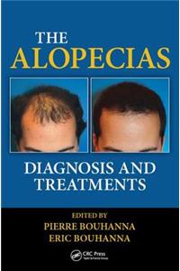 Alopecias
