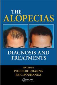 The Alopecias