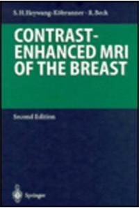 Contrast-Enhanced MRI of the Breast