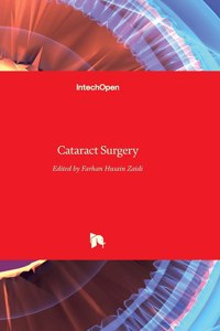 Cataract Surgery