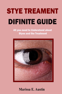Stye Treatment Difinite Guide