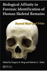 Biological Affinity in Forensic Identification of Human Skeletal Remains