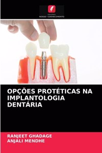 Opções Protéticas Na Implantologia Dentária