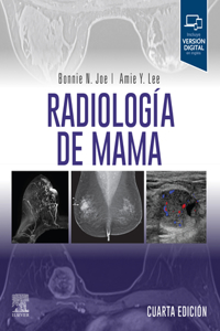 Radiología de Mama