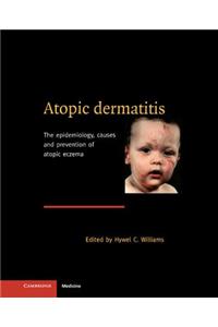 Atopic Dermatitis