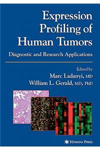 Expression Profiling of Human Tumors