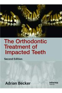 Orthodontic Treatment of Impacted Teeth