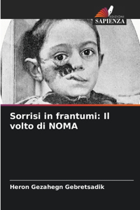 Sorrisi in frantumi