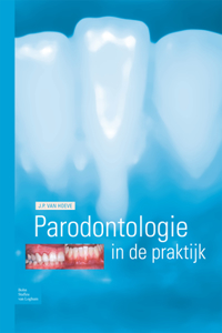 Parodontologie in de Praktijk