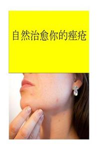 Cure Your Acne Certu