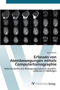 Erfassen von Atembewegungen mittels Computertomographie