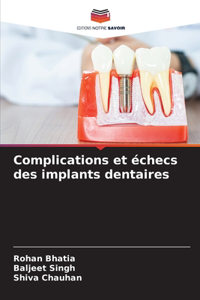 Complications et échecs des implants dentaires