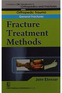 Fracture Treatment Methods (Handbook In Orthopedics And Fractures Vol.02 - Orthopedic Trauma General Fractures)