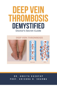 Deep Vein Thrombosis Demystified