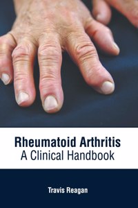 Rheumatoid Arthritis: A Clinical Handbook