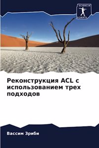 Реконструкция ACL с использованием трех по&#