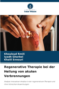 Regenerative Therapie bei der Heilung von akuten Verbrennungen