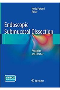 Endoscopic Submucosal Dissection