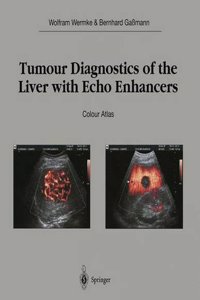Tumour Diagnostics of the Liver with Echo Enhancers
