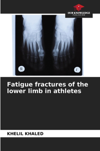 Fatigue fractures of the lower limb in athletes