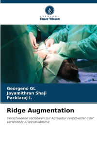 Ridge Augmentation