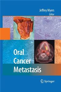 Oral Cancer Metastasis