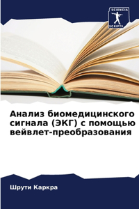 Анализ биомедицинского сигнала (ЭКГ) с пом
