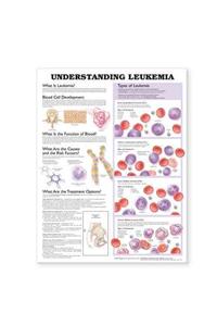 Understanding Leukemia Anatomical Chart