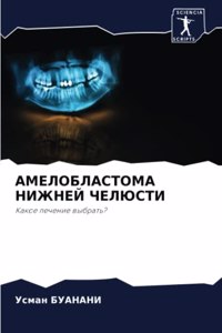АМЕЛОБЛАСТОМА НИЖНЕЙ ЧЕЛЮСТИ