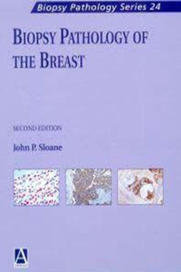 Biopsy Pathology of the Breast