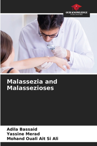 Malassezia and Malassezioses