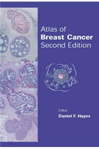 Atlas of Breast Cancer