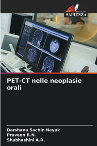 PET-CT nelle neoplasie orali