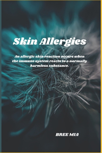 Skin Allergies